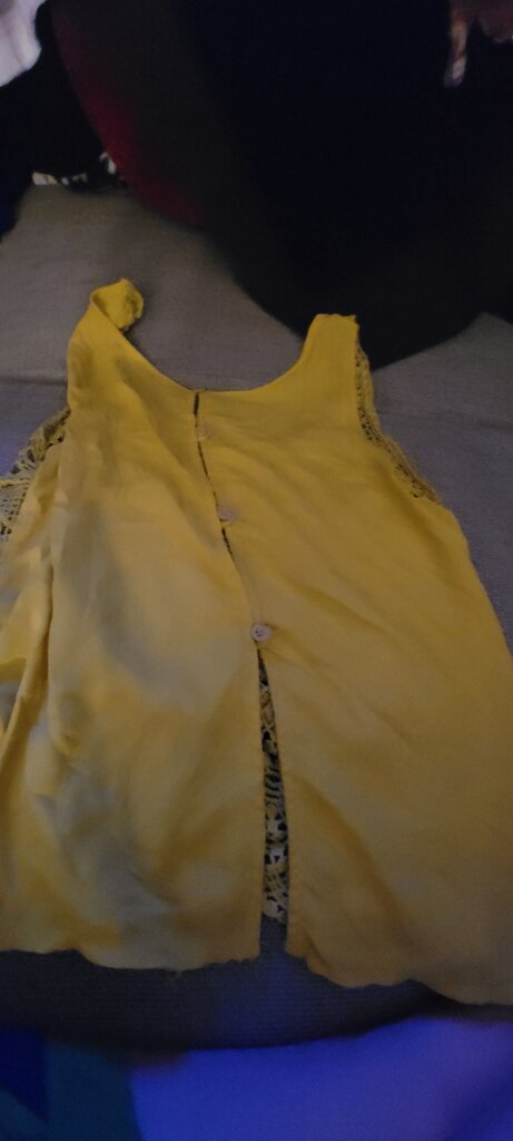 Yellow Lace Detail Dress